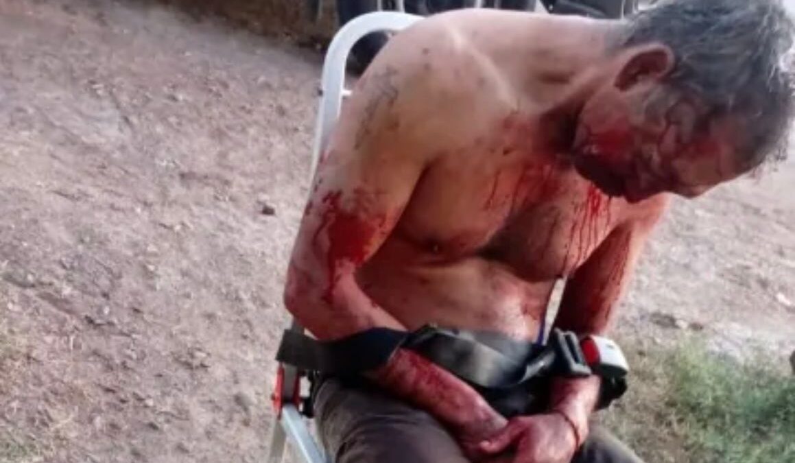 Descubrió que su esposa lo engañaba con su tío y lo atacó brutalmente en Sarmiento